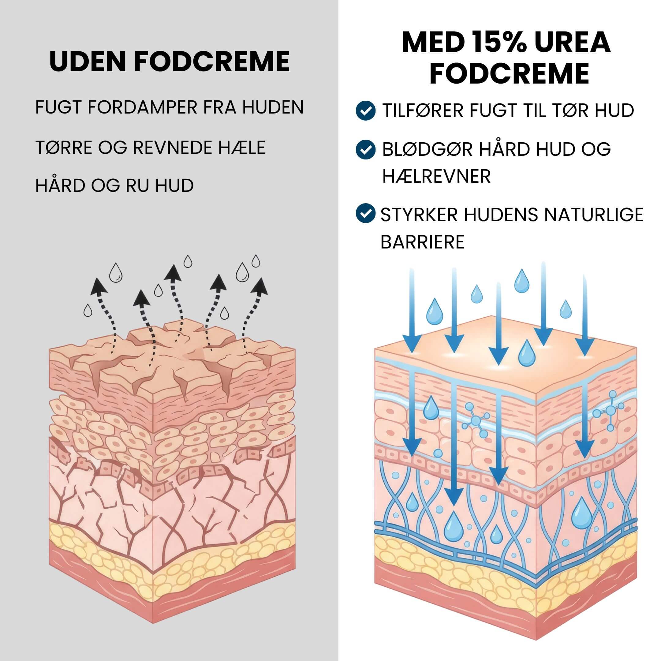 Bløde Fødder